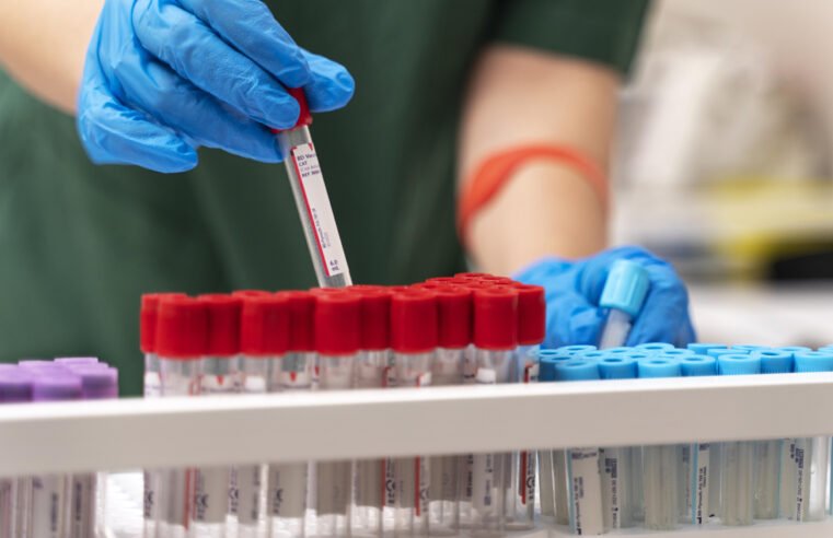 Allegro: Fast and Simple Capillary Blood Analysis Revolutionizing Point-of-Care Testing