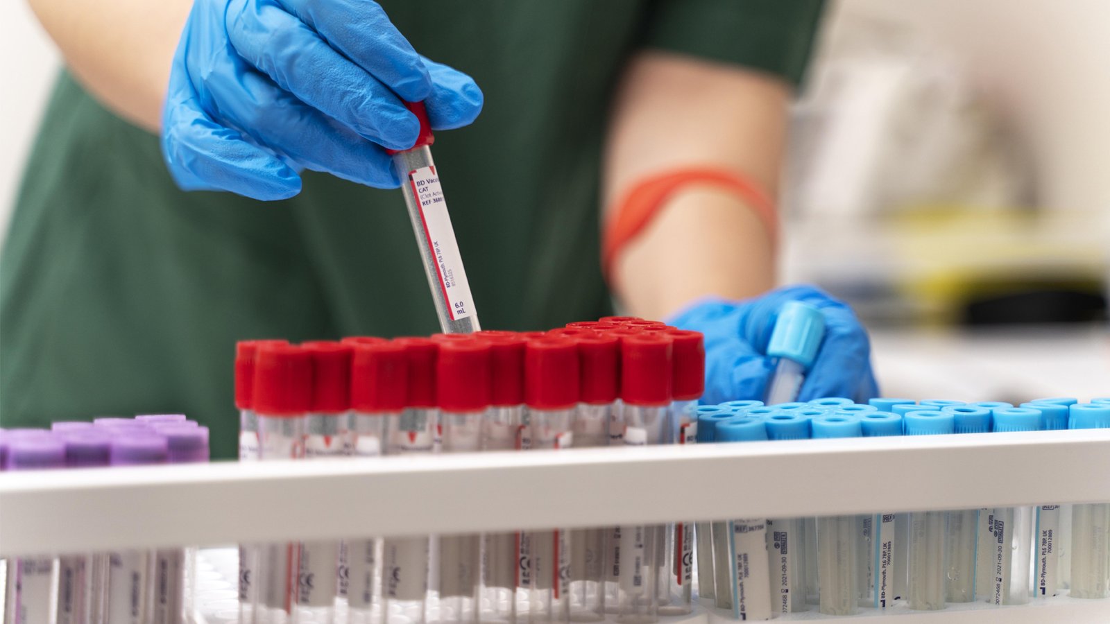 Allegro: Fast and Simple Capillary Blood Analysis Revolutionizing Point-of-Care Testing